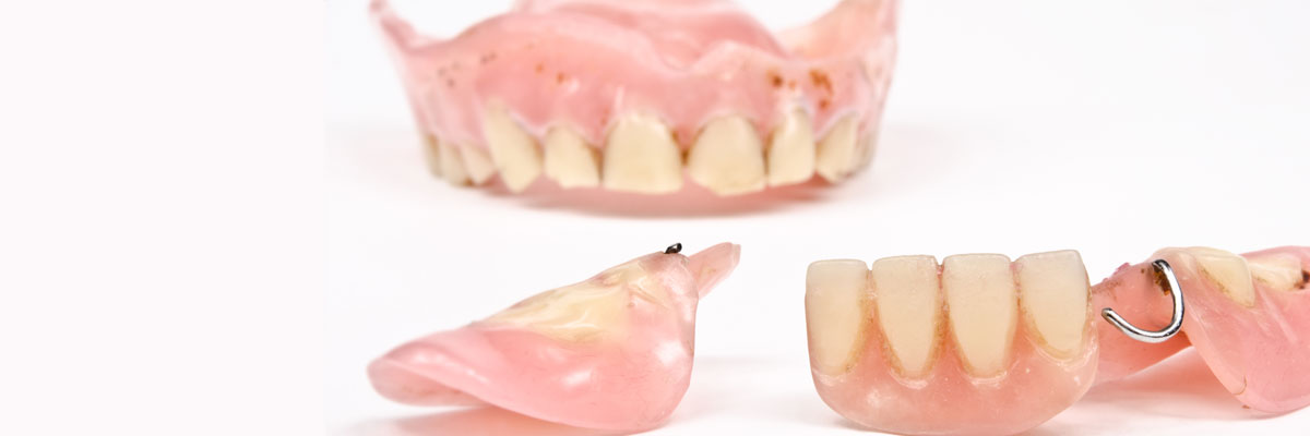 Solvang What Do I Do If I Damage My Dentures?