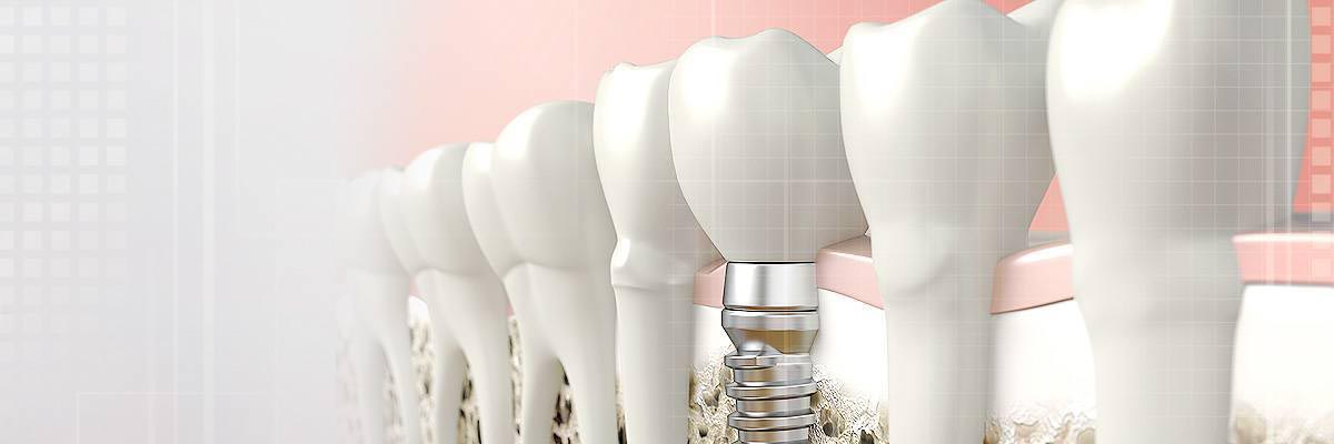 Solvang Dental Prosthetics