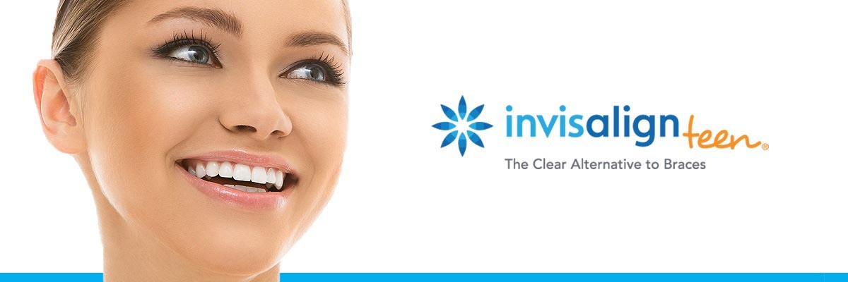 Solvang Invisalign vs Traditional Braces