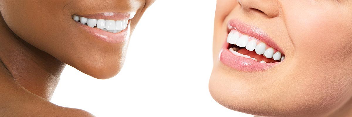 Solvang Teeth Whitening