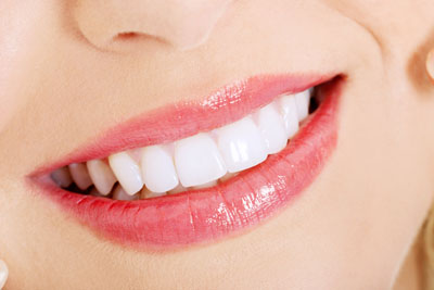 Teeth Whitening Dentist In Solvang: Your Solution For Stained Teeth