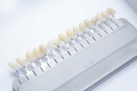 Find The Answer To: Can Veneers Fix Crooked Teeth?